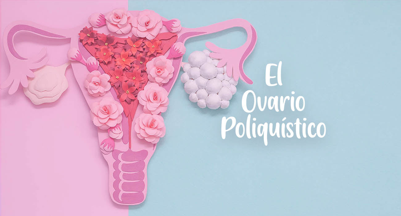 Ovario políquístico